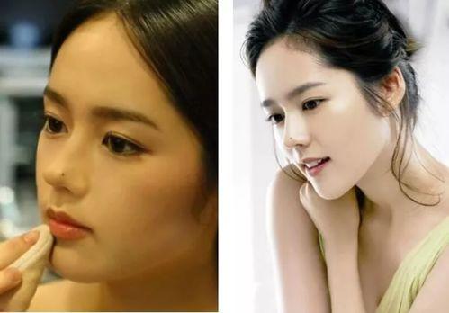 女明星鼻子整形,美丽背后的秘密